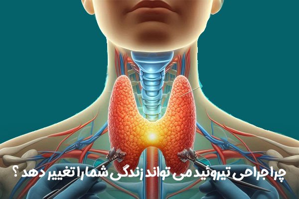 جراحی تیروئید